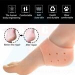ANCS Acupressure Heel AntiCrack Silicone Foot Free Size - Pair - Image 2