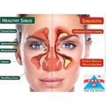 ancs-jal-neti-pot-still-neti-kirya-pot