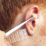 ancs-ear-acupuncture-needle-press-needling