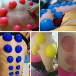 ANCS Silicone Vacuum Cupping Set, 12 Pieces, Half Ball Cupping Therapy Cans, Rubber Body Slimming Suction Cups Set Of 12 - Image 2